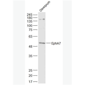 Anti-EphA7  antibody-酪氨酸蛋白激酶受体A7抗体
