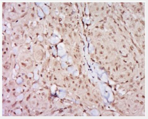 Anti-GATA3  antibody-GATA结合蛋白3抗体,GATA3