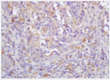 Anti-RAF1  antibody-癌基因RAF1抗體,RAF1