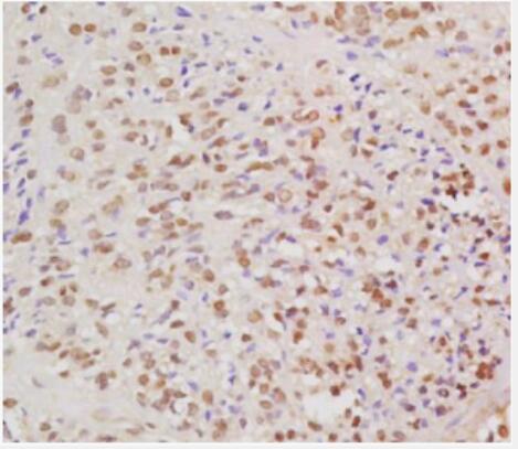 Anti-HPV16 E6 antibody-人类乳头状瘤病毒16抗体,HPV16 E6