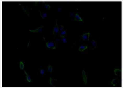 Anti-EGF antibody-表皮生長(zhǎng)因子抗體,EGF