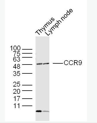 Anti-CCR9 antibody-细胞表面趋化因子受体9抗体,CCR9