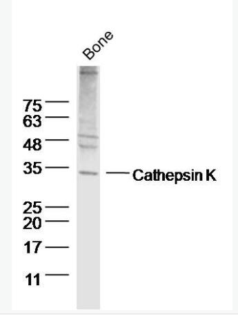 Anti-Cathepsin K antibody-组织蛋白酶K抗体,Cathepsin K