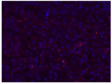 Anti-HBsAg antibody-山羊抗人乙肝表面抗原抗体（包被）,HBsAg