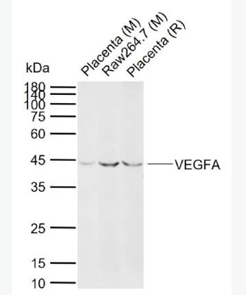 Anti-VEGFA antibody-血管内皮生长因子A抗体,VEGFA