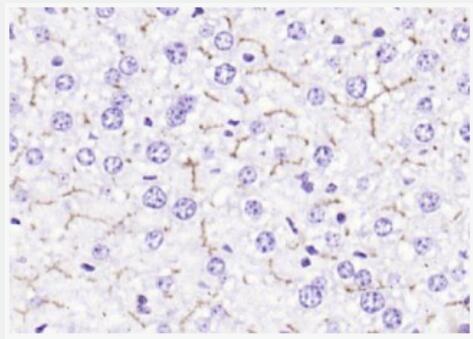 Anti-ABCB11 antibody-胆汁酸盐输出泵抗体,ABCB11