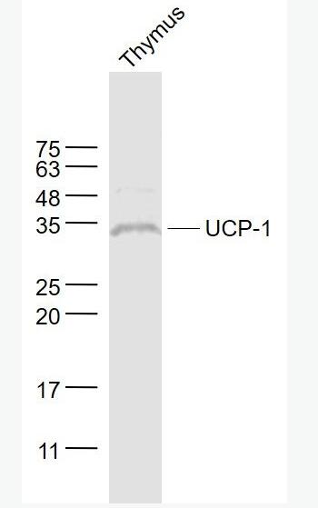 Anti-UCP-1 antibody-线粒体脱偶连蛋白1抗体,UCP-1