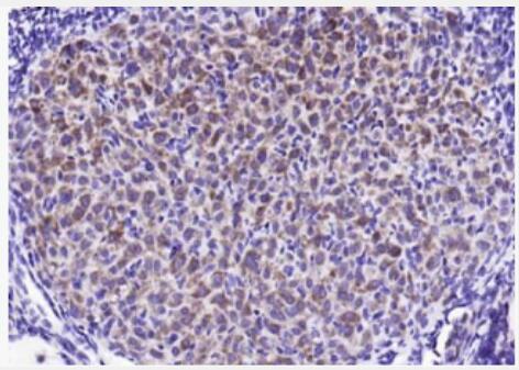 Anti-STMN1 antibody-白血病相關(guān)蛋白18/癌蛋白18抗體,STMN1