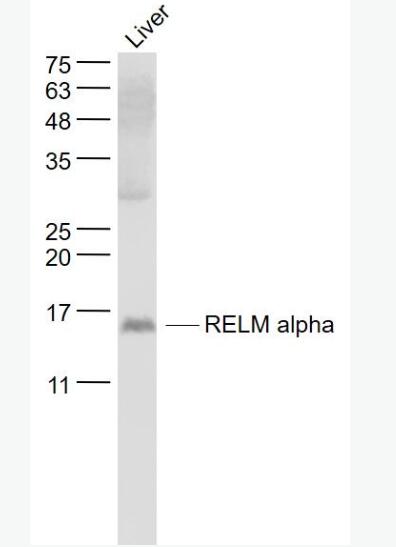 Anti-RELM alpha antibody-抵抗素样分子α抗体,RELM alpha