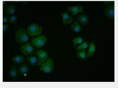 Anti-PDCD1LG2 antibody-程序性死亡配体2（CD273）抗体,PDCD1LG2