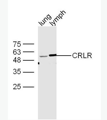 Anti-CALCRL antibody-降钙素基因相关肽1型受体抗体,CALCRL