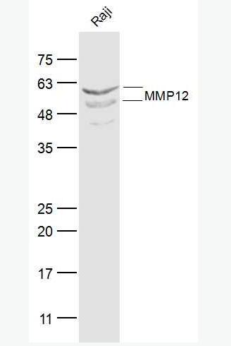 Anti-MMP12 antibody-基質(zhì)金屬蛋白酶-12抗體,MMP12