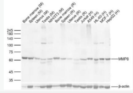 Anti-MMP8 antibody-基质金属蛋白酶-8/胶原酶2抗体,MMP8