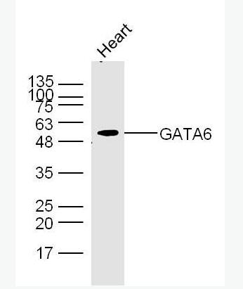 Anti-GATA6 antibody-GATA结合蛋白6抗体,GATA6