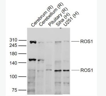 Anti-ROS1  antibody-原癌基因ROS1抗体,ROS1