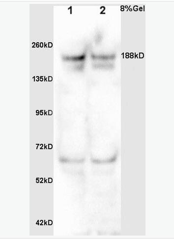 Anti-MDC1 antibody-DNA损伤关卡蛋白1抗体,MDC1