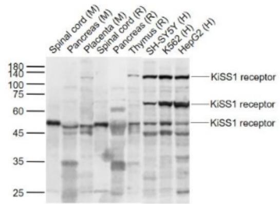 Anti-KiSS1 receptor antibody-G蛋白偶联受体54抗体,KiSS1 receptor