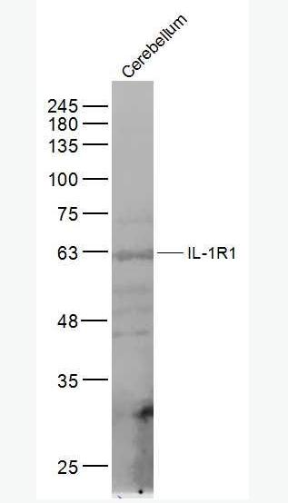 Anti-IL-1R1 antibody-白介素1受体1抗体,IL-1R1