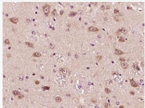 Anti-IL22BP antibody-白介素22受体结合蛋白抗体,IL22BP