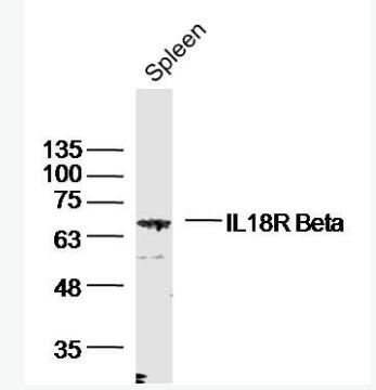 Anti-IL18R Beta antibody-白细胞介素-18受体β链抗体,IL18R Beta