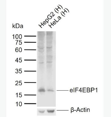 Anti-eIF4EBP1 antibody-eIF4E结合蛋白抗体,eIF4EBP1