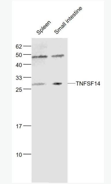 Anti-TNFSF14 antibody-腫瘤壞死因子配體超家族成員14抗體,TNFSF14