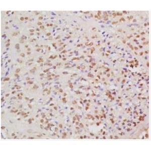 Anti-HPV16 E6 antibody-人类乳头状瘤病毒16抗体