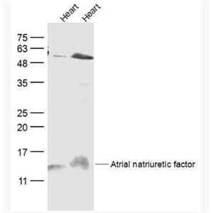 Anti-Atrial natriuretic factor antibody-心房钠尿因子/心钠素/心房利钠肽/ANP抗体,Atrial natriuretic factor