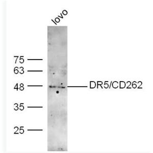 Anti-DR5  antibody-肿瘤细胞调亡素/死亡受体5抗体