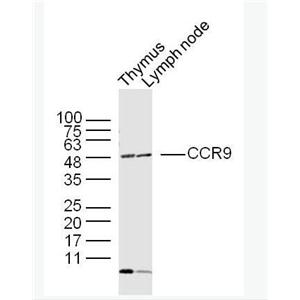 Anti-CCR9 antibody-细胞表面趋化因子受体9抗体