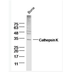Anti-Cathepsin K antibody-组织蛋白酶K抗体