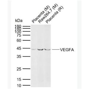 Anti-VEGFA antibody-血管内皮生长因子A抗体