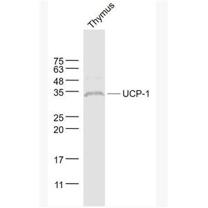 Anti-UCP-1 antibody-线粒体脱偶连蛋白1抗体