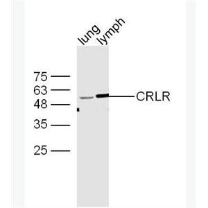 Anti-CALCRL antibody-降钙素基因相关肽1型受体抗体,CALCRL