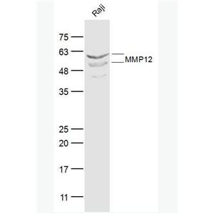 Anti-MMP12 antibody-基质金属蛋白酶-12抗体,MMP12
