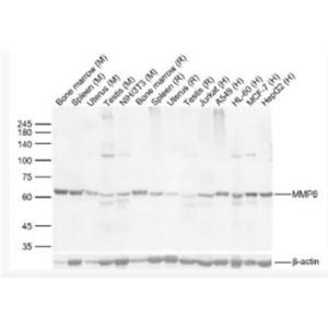 Anti-MMP8 antibody-基质金属蛋白酶-8/胶原酶2抗体,MMP8