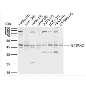 Anti-IL13RA2 antibody-白细胞介素13受体a2抗体