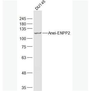 Anti-ENPP2 antibody-自分泌运动因子抗体