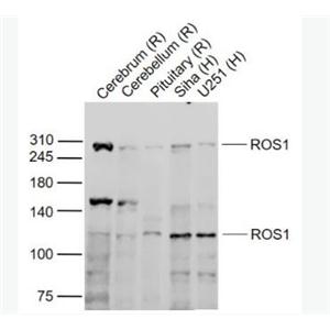 Anti-ROS1  antibody-原癌基因ROS1抗体