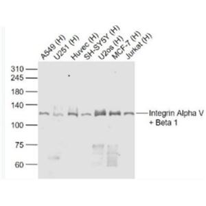 Anti-Integrin Alpha V + Beta 1 antibody-整合素αVβ1抗体,Integrin Alpha V + Beta 1