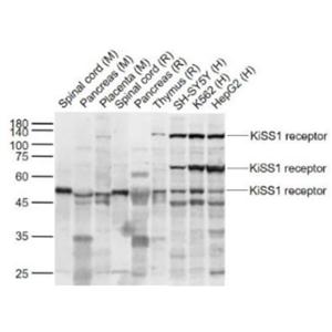 Anti-KiSS1 receptor antibody-G蛋白偶联受体54抗体