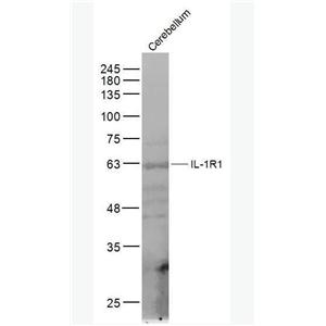 Anti-IL-1R1 antibody-白介素1受体1抗体,IL-1R1