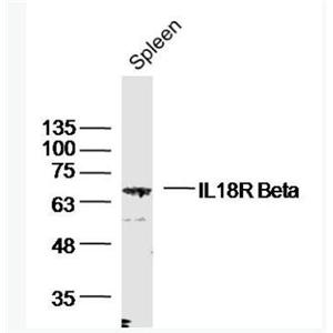 Anti-IL18R Beta antibody-白细胞介素-18受体β链抗体,IL18R Beta