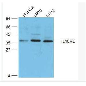 Anti-IL10RB antibody-白细胞介素-10受体β抗体