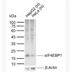 Anti-eIF4EBP1 antibody-eIF4E结合蛋白抗体