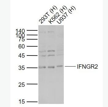 Anti-IFNGR2 antibody-干扰素-gamma受体2/干扰素-gamma受体β/IFN-γRβ抗体,IFNGR2