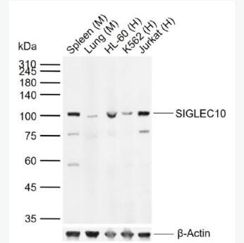 Anti-SIGLEC10 antibody-腫瘤壞死因子配體超家族成員14抗體,SIGLEC10