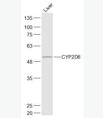 Anti-CYP2D6 antibody-细胞色素P450 2D6抗体,CYP2D6