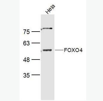 Anti-FOXO4 antibody-叉头蛋白O4抗体,FOXO4