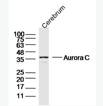 Anti-Aurora C antibody-有丝分裂激酶B抗体,Aurora C